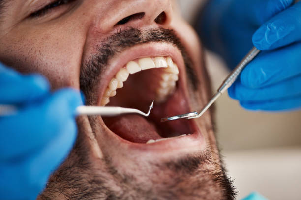 Best Emergency Treatment for Dental Infections or Abscesses in Turners Falls, MA